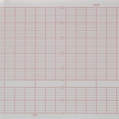 Лента тепл. регист. для CTG(FM) BIOSYS IFM-500 120×120х250, К120Z120АК250, 8